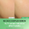 Picture of Torriden Balanceful Cica Serum: Experience Radiant Skin with Soothing Hydration